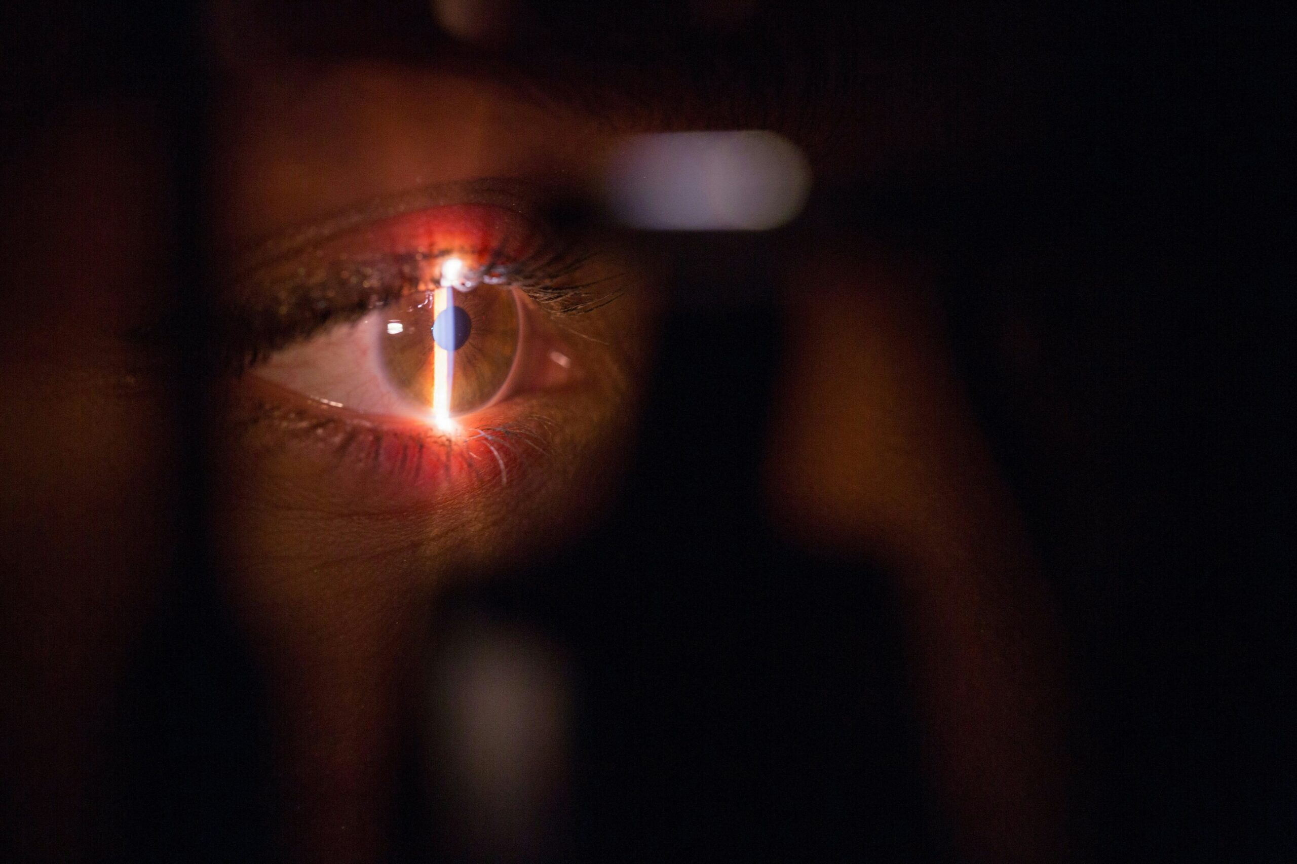 LASIK, PKR ou SMILE : quelle chirurgie réfractive choisir ?